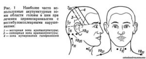 Немеет переносица, одна часть левой стороны