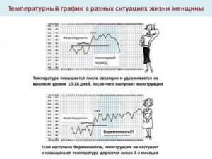 Температура 38 при беременности 14 недель