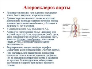 Склероз аорты. ИКС