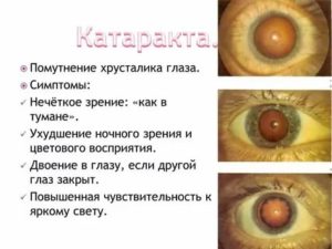Пропало зрение на одном глазу