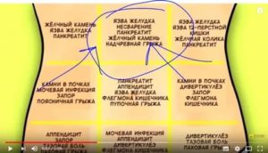 Тяжесть вверху живота