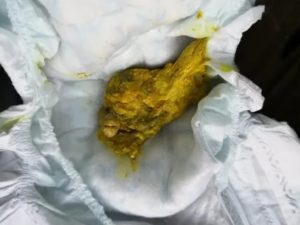 Колики, зеленый стул с белыми комочкам