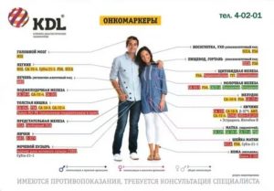 Повышен СА 72-4 может это быть онкология?