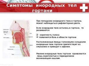 Ощущение инородного тела в горле, кость в горле