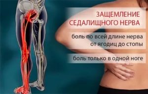 Боль в пояснице, отдает в левую ногу, онемение конечностей