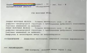 О результатах мамографии