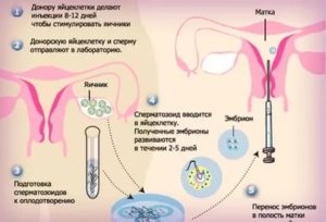 Месячные после донорства ооцитов