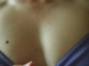 На груди выскочило что-то