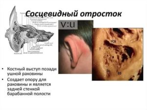 Сосцевидный отросток