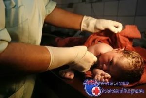 28 неделя кесарево гестоз