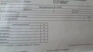 Бакпосев анализов, гарднереллёз