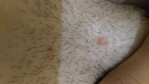 Шарик на интимной зоне