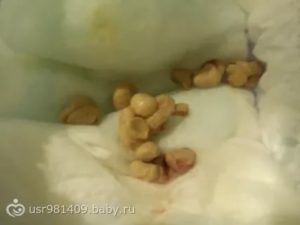 Ребёнок плохо какает