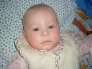 Припухлость на лбу у ребенка