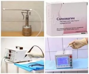 Сколько раз прижигать Солковагином
