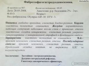 Результаты эфгдс