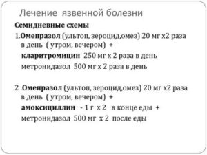 Схема лечения язвы желудка