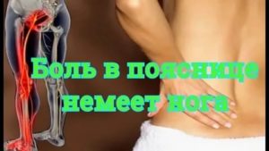Боль в пояснице, отдает в левую ногу, онемение конечностей