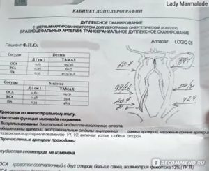 Расшифровка узи сосудов шеи