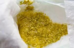 Слизистый стул с непереваренными комочками