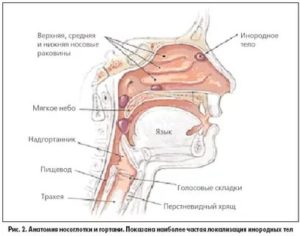 Ощущение инородного тела в горле, кость в горле