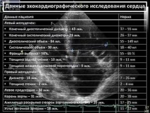 Расшифровка результата ЭхоКг