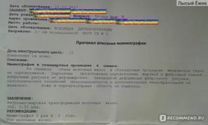 О результатах мамографии