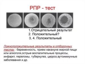 Рмп или рпр