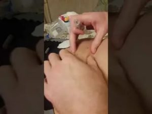 Куда лучше колоть клексан?