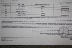 Результаты ПГД