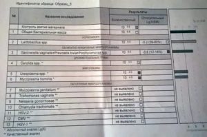 Анализ ифа на уреаплазму